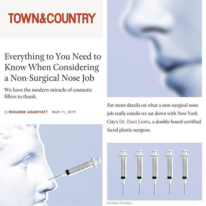 Media article: Town & Country - Everything you need to know when considering a non-surgical nose job