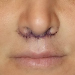 Before and After Image