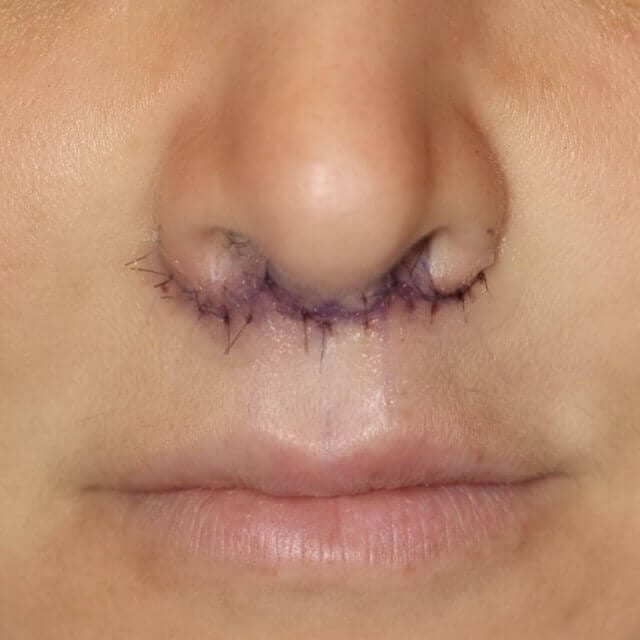 Before and After Image