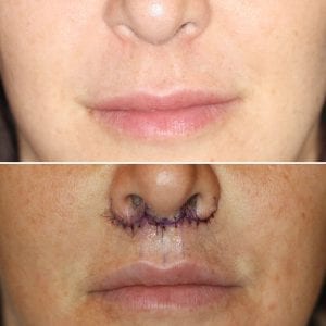 Before and After Image