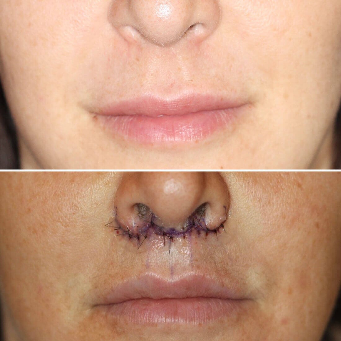 Before and After Image