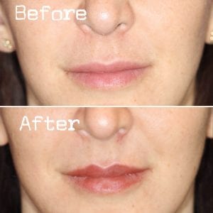 Before and After Image