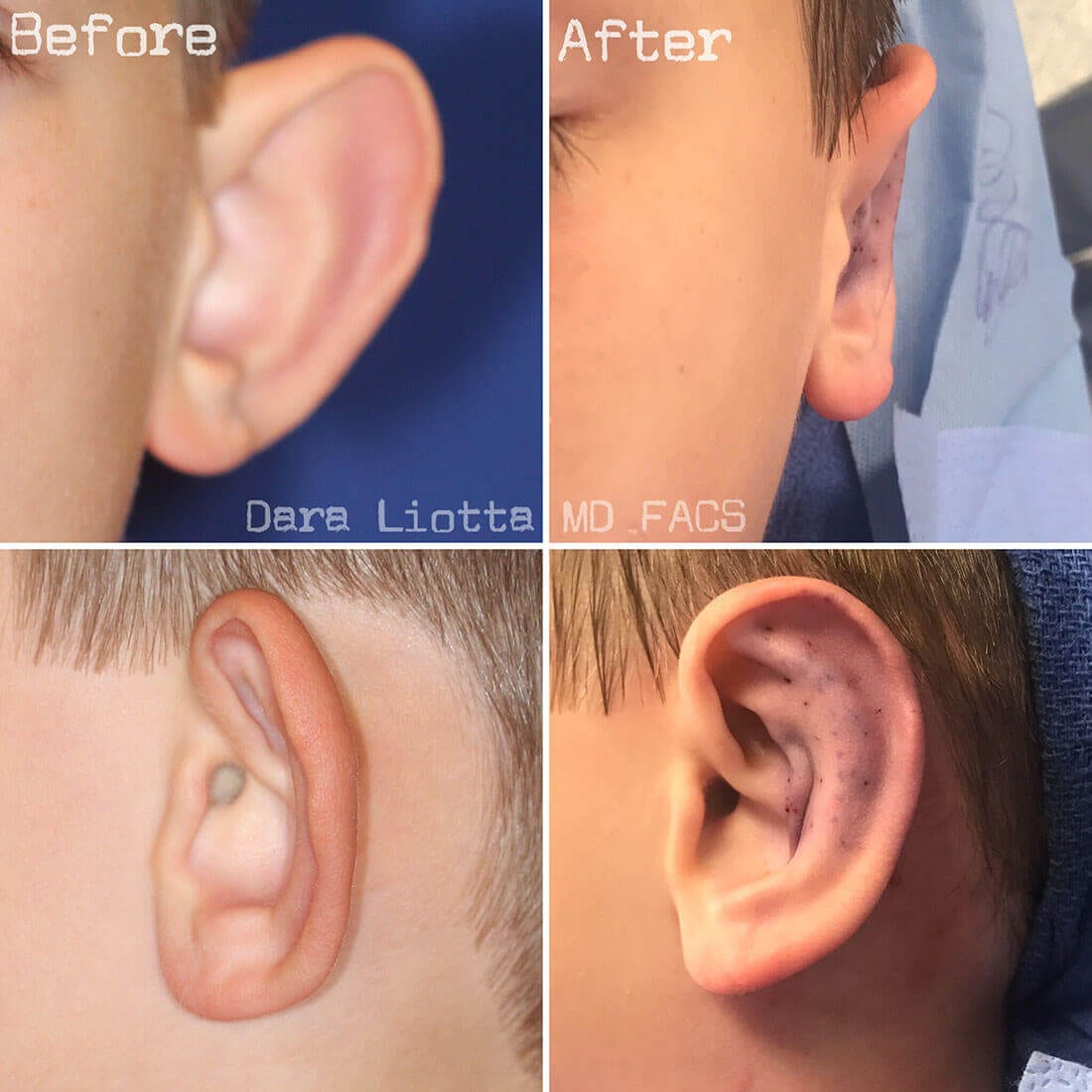 Before and After Image